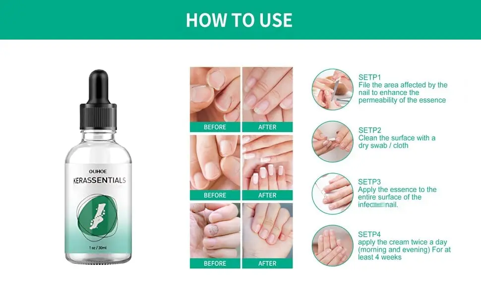 Kerassentials